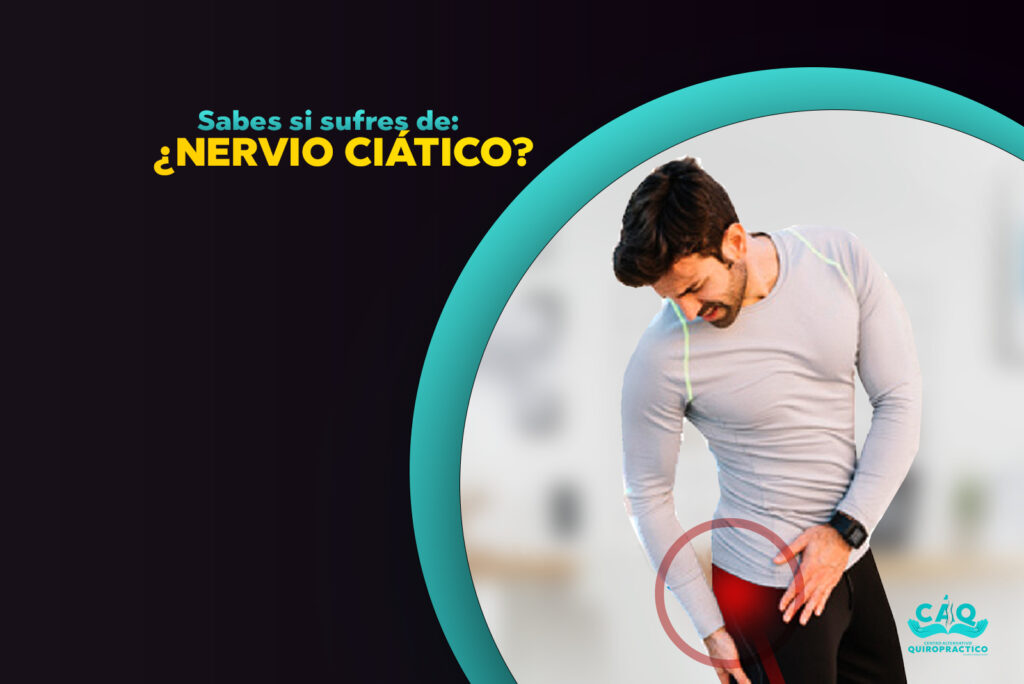 Nervio ciatico